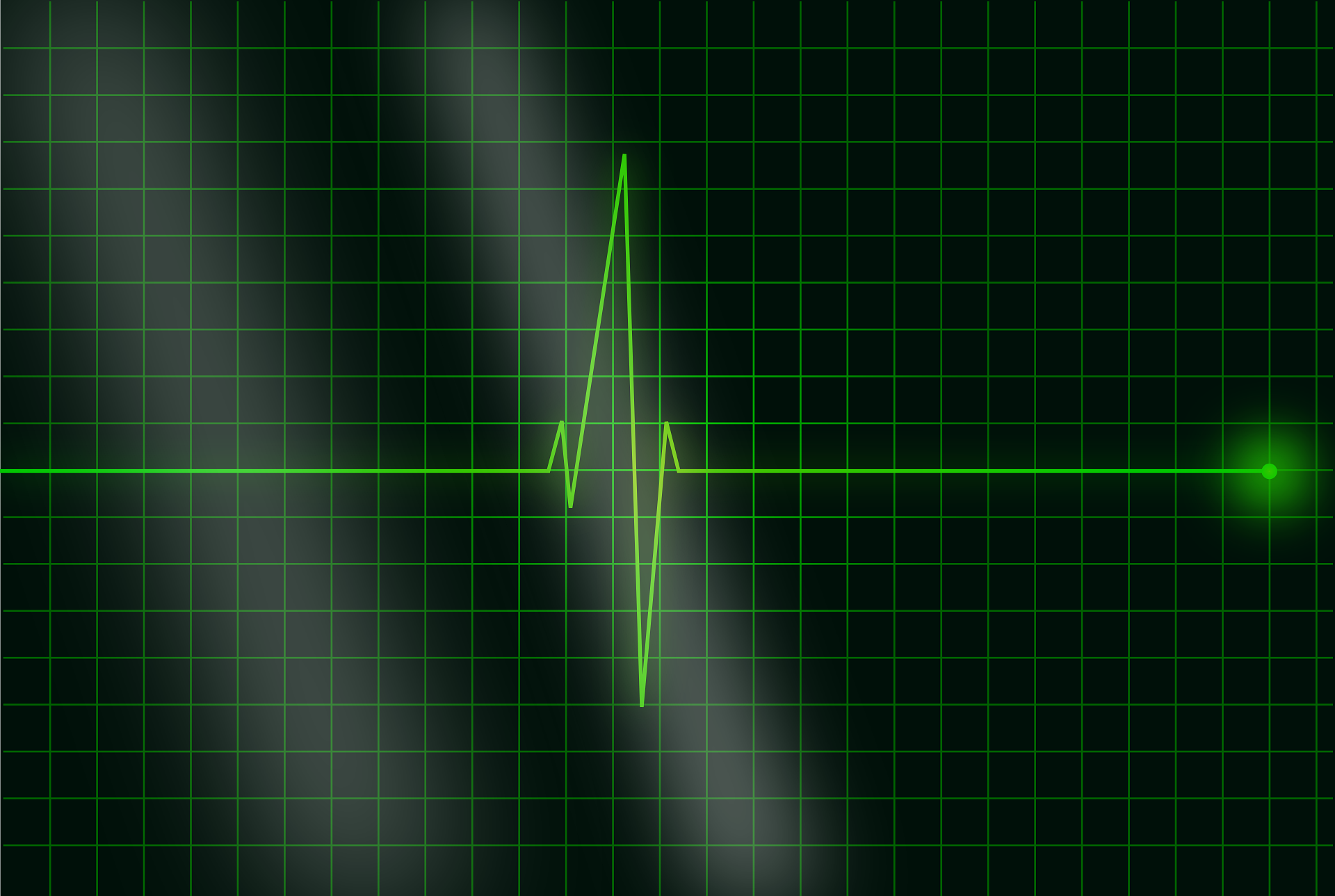 A heart beat or pulse rate pinging on a chart, like on a hospital screen.